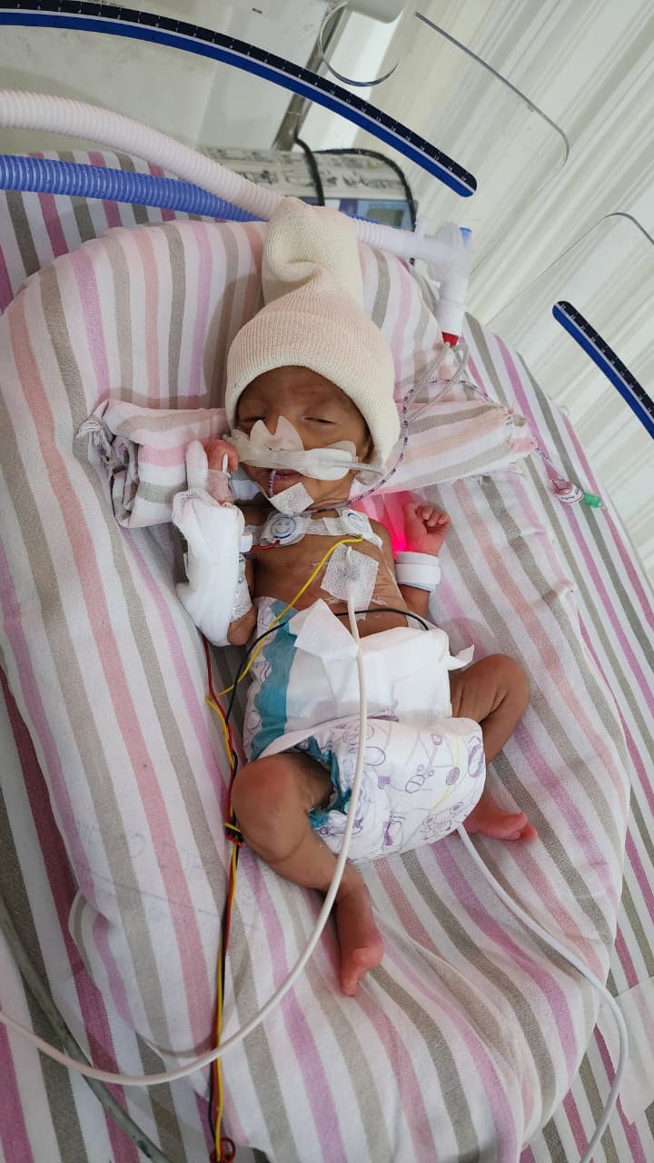 Save Baby Zehra Fatima – She Needs an Urgent Life-Saving Heart Procedure